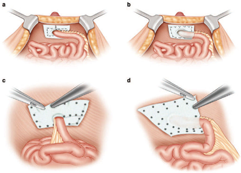 Điều gì xảy ra với một prostomatology? 